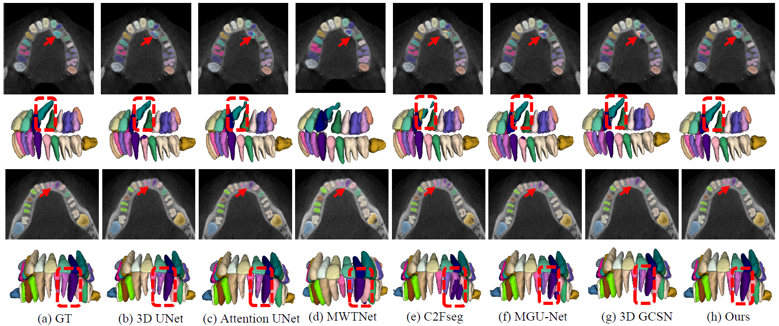 semantic-graph-attention-with-explicit-anatomical-association-modeling-for-tooth-segmentation